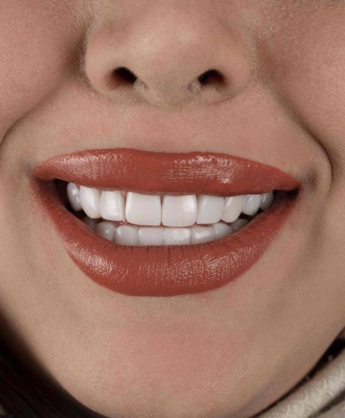 خدمات کامپوزیت در شریعتی